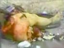 Suicide Bombing