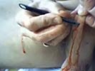 mutilate cock